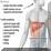Hepatitis liver picture