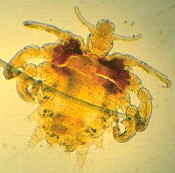 genital crabs pubic lice